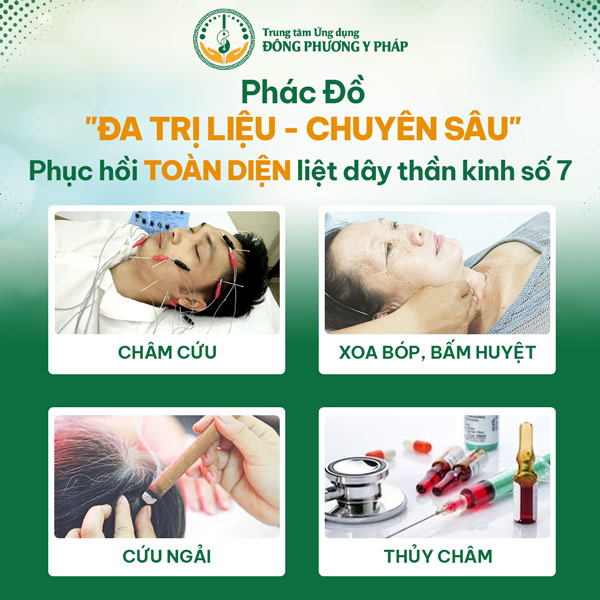 Phác đồ chữa liệt dây thần kinh số 7